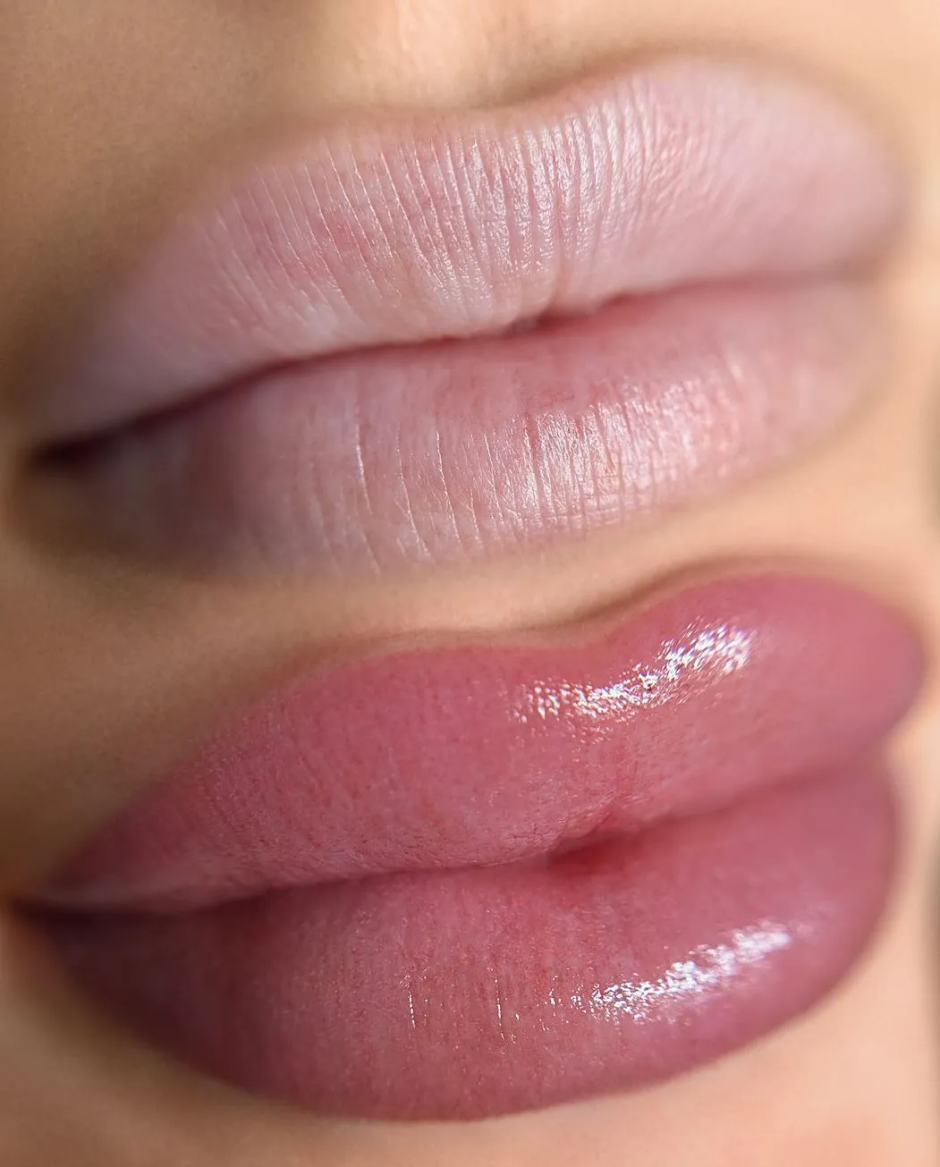 Day Trip Creative | Should You Get Lip Blush or Fillers First? How do I do this at Face Figurati