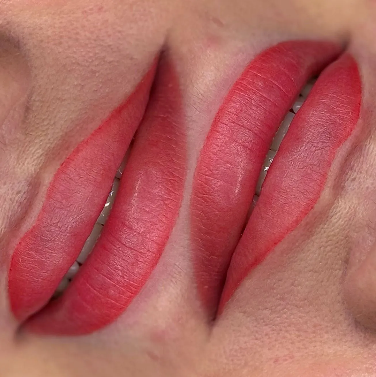 Day Trip Creative | Should You Get Lip Blush or Fillers First? Treatment timeline, What to expect and when