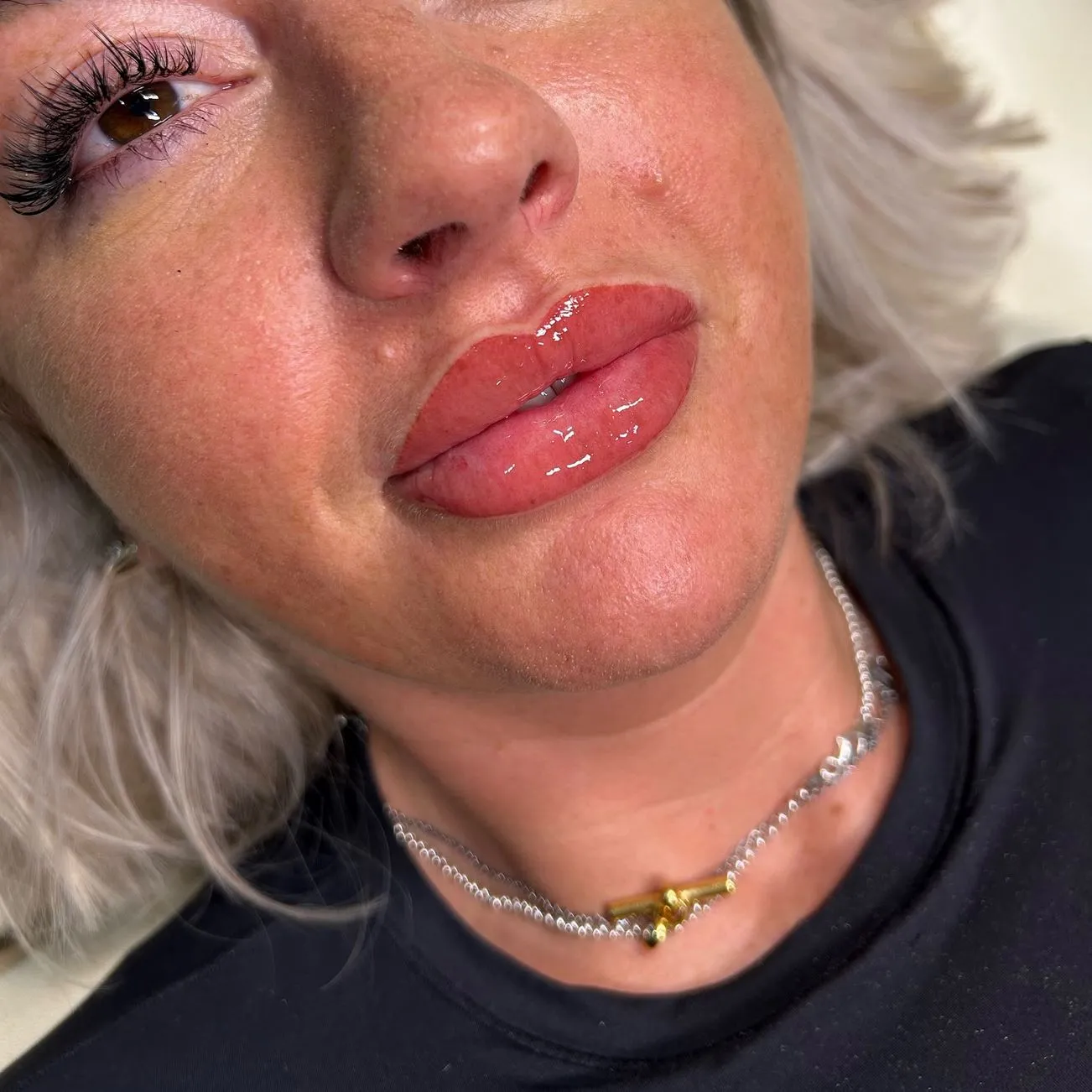 Day Trip Creative | Should You Get Lip Blush or Fillers First? What if you get blush before filler