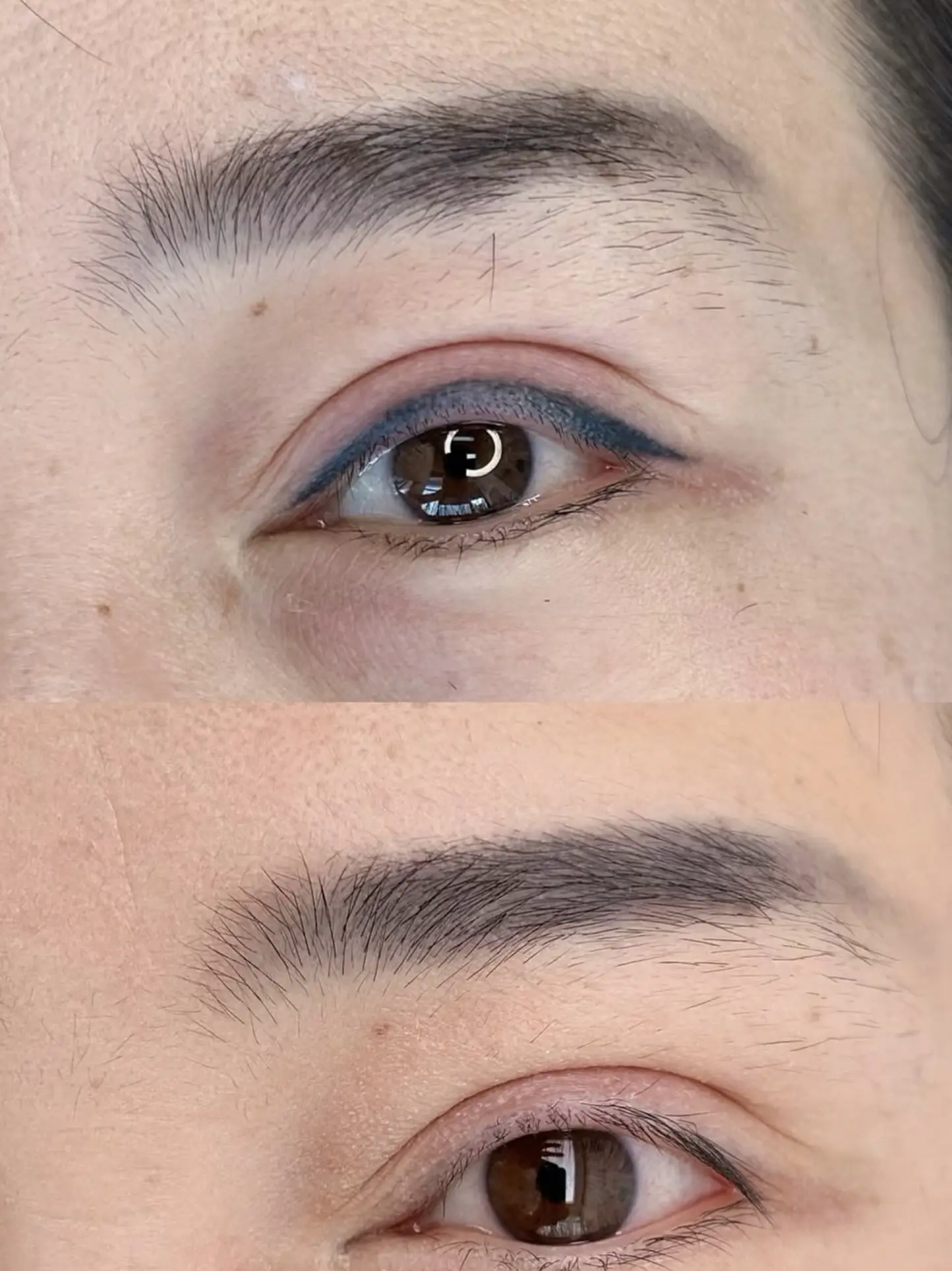 Day Trip Creative | Can you reverse an eyeliner tattoo? eyeliner tattoo removal Melbourne