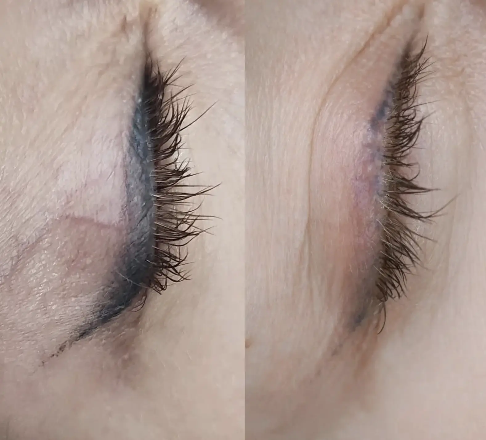 Day Trip Creative | Can you reverse an eyeliner tattoo? eyeliner tattoo removal cost