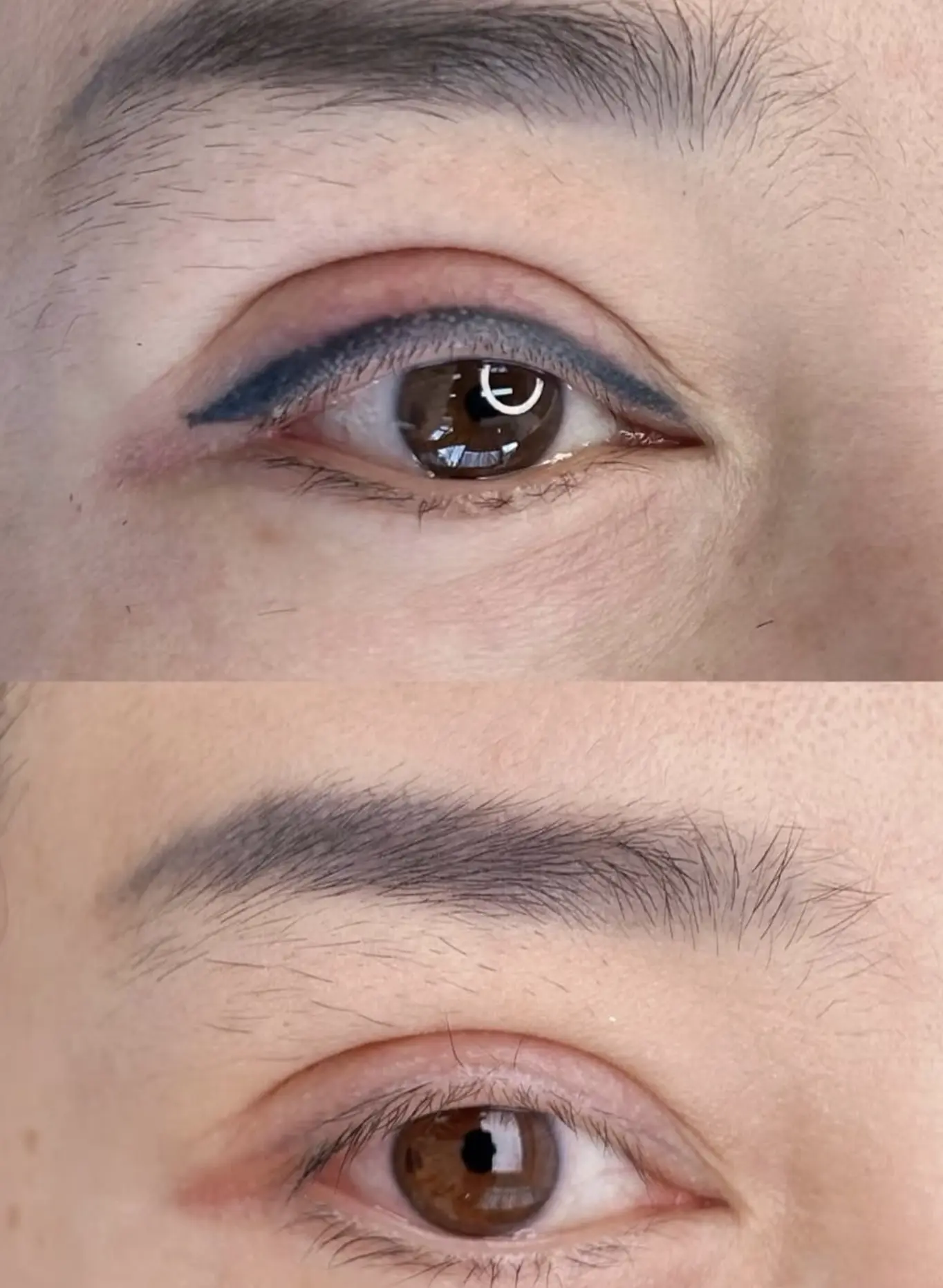 Day Trip Creative | Can you reverse an eyeliner tattoo? laser eyeliner tattoo removal