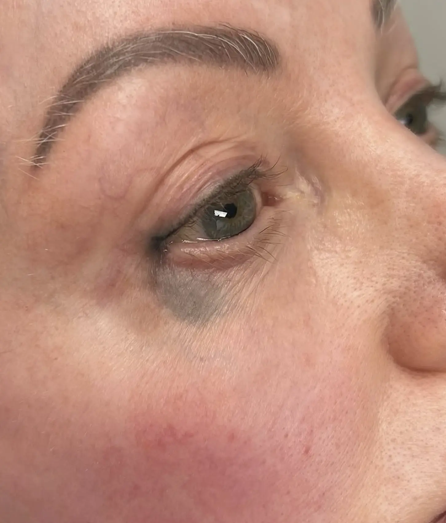 Day Trip Creative | Can you reverse an eyeliner tattoo? permanent eyeliner removal